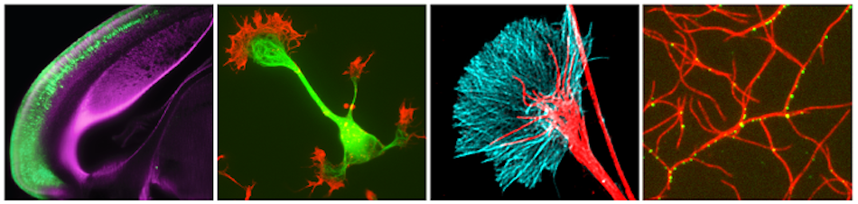 Cytoskeleton club - Coralie Fassier